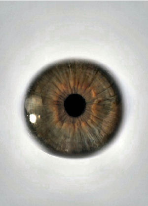 Figure 2 - Eyeball