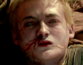 dead-joffrey